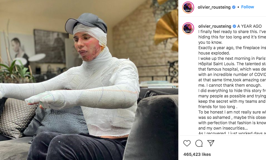 Captura de pantalla de la imagen con la que Olivier Rousteing mostró sus quemaduras de las cuales ya se ha recuperado. Tomada del perfil oficial en Instagram del diseñador francés. Captura de pantalla de la imagen con la que Olivier Rousteing mostró sus quemaduras de las cuales ya se ha recuperado. Tomada del perfil oficial en Instagram del diseñador francés.