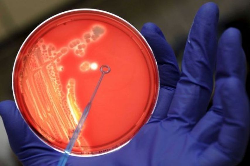 Aunque los casos de infección no son habituales, las personas con sistemas inmunológicos débiles o enfermedades crónicas al hígado son más vulnerables, y podrían fallecer al ser expuestos