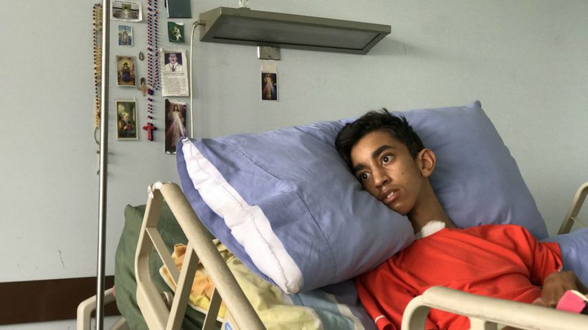 Navarrete fue impactado por una lacrimógena el pasado 18 de mayo, lo cual le generó una arritmia y le colapsó los pulmones.