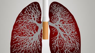 El consumo de tabaco es el principal factor de riesgo de cáncer de pulmón. La tasa de tabaquismo en Florida es del 14,7%, que es similar a la tasa nacional del 13,5%.