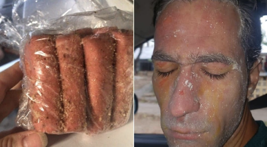 El paquete de croquetas y el rostro de la persona que sufri&oacute; las quemaduras.&nbsp;