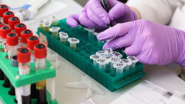 Investigador trabaja en el laboratorio.&nbsp;