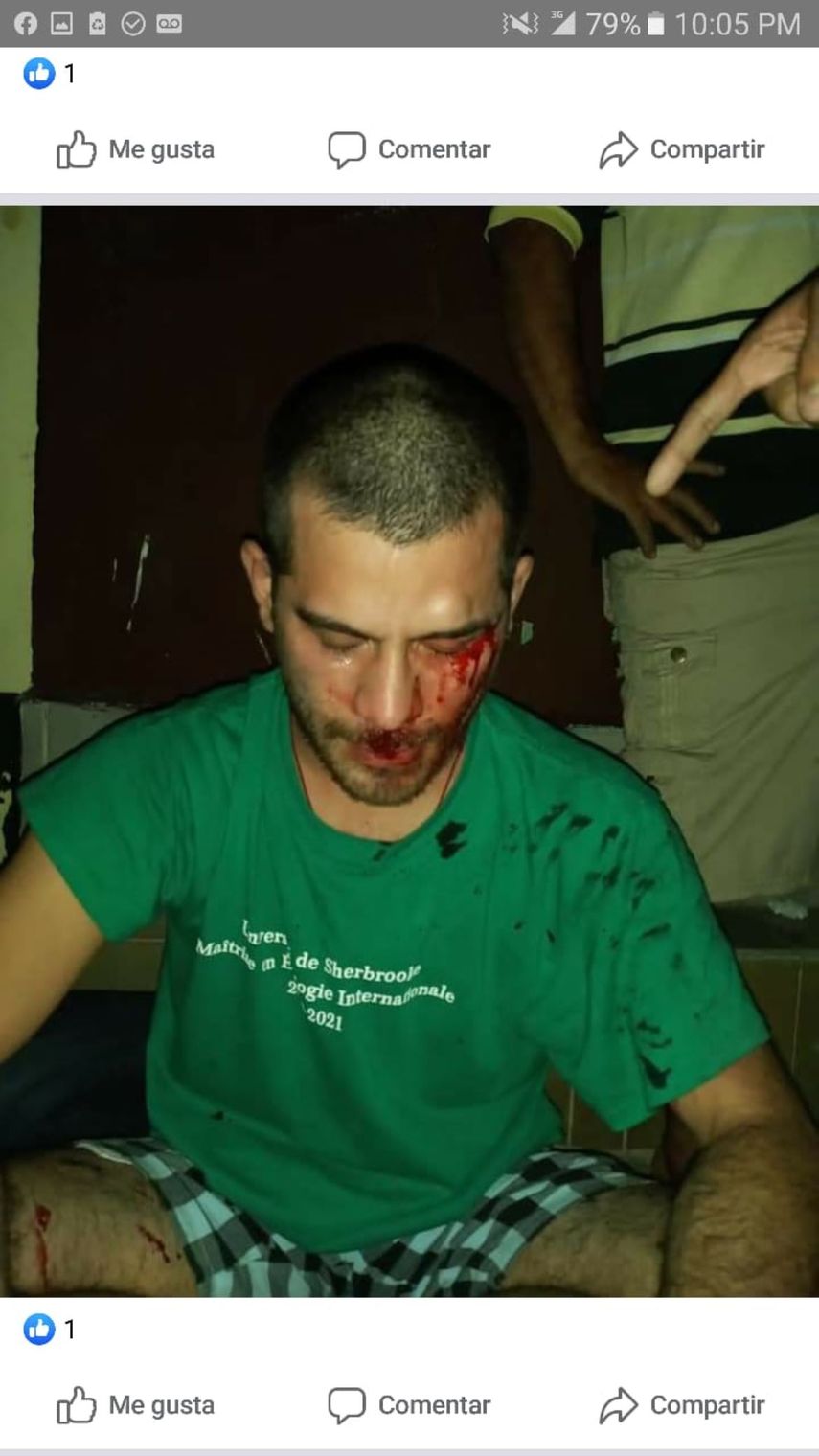 Uno de los cuatro j&oacute;venes agredidos por paramilitares del r&eacute;gimen de Daniel Ortega.