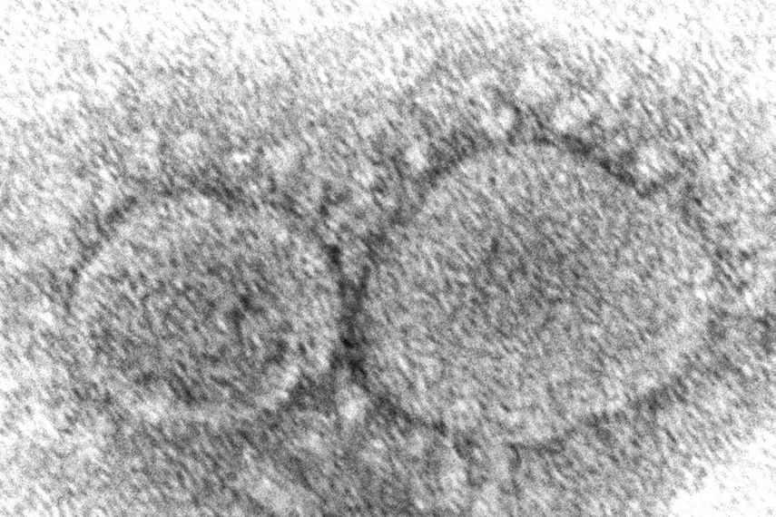 En esta imagen de microscopio de 2020 difundida por los Centros para el Control y la Prevención de Enfermedades se ven partículas del virus SARS-CoV-2, que causa el COVID-19.