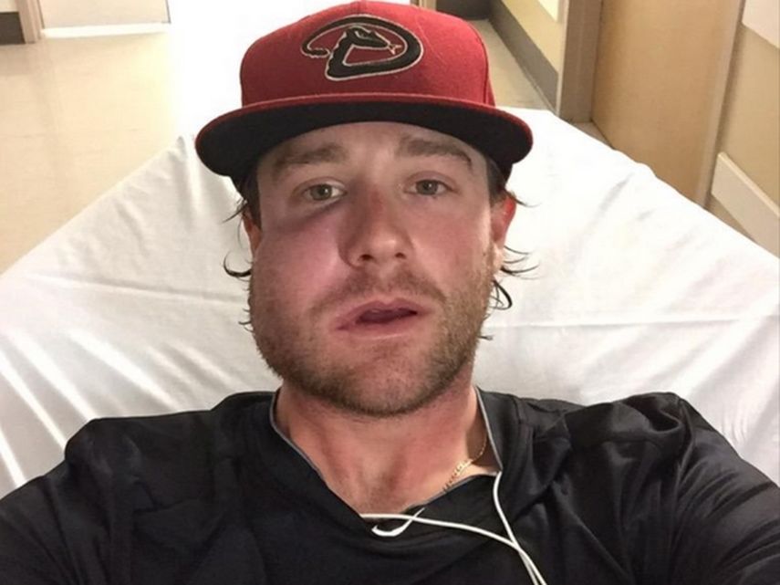 El pitcher fue golpeado en su rostro por un batazo disparado por el venezolano Carlos González