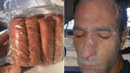 El paquete de croquetas y el rostro de la persona que sufri&oacute; las quemaduras.&nbsp;