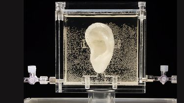 En esta imagen sin fecha una oreja creada a partir de células humanas proporcionadas por un pariente lejano del artista holandés Vincent van Gogh se exhibe en el Centro para las Artes y Medios en Karlsruhe, Alemania. (AP)