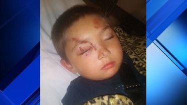 Carter English fue atacado por un grupo de niños de su edad fuera de su hogar en Olympia.