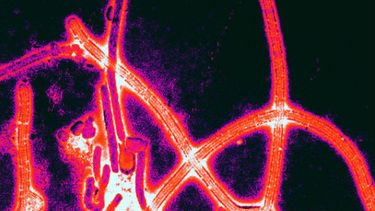 Microfotografía electrónica del virus de ébola ( Foto: Wikimedia)