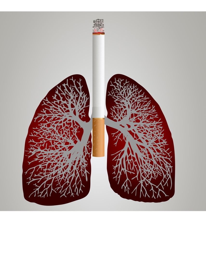 El consumo de tabaco es el principal factor de riesgo de cáncer de pulmón. La tasa de tabaquismo en Florida es del 14,7%, que es similar a la tasa nacional del 13,5%.