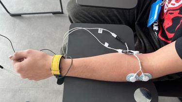 Una terapia experimental de estimulación eléctrica periférica puede reducir el temblor de los pacientes de Parkinson.
