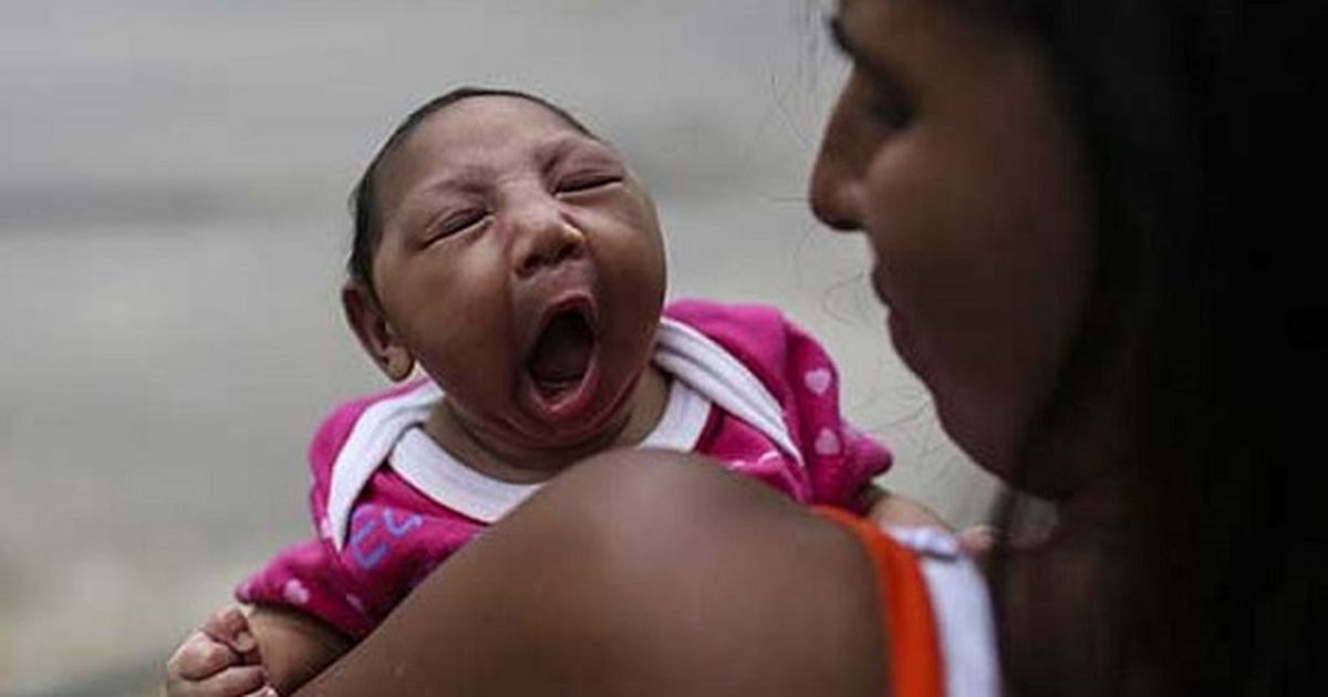 Primer caso de microcefalia por zika en Puerto Rico