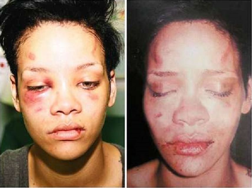 La cantante Rihanna fue golpeada por su exnovio el rapero Chris Brown.&nbsp;