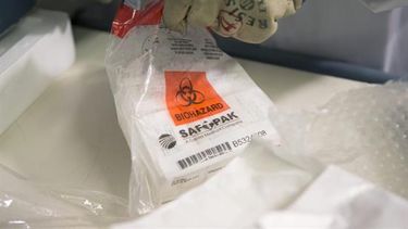 ensayos clinicos de vacuna contra ebola empezaran en suiza el 1 de noviembre