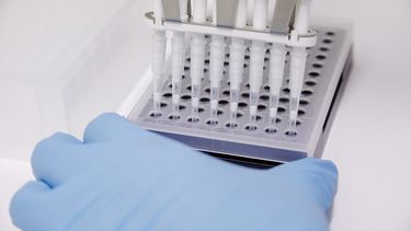 Una técnico de laboratorio prepara una PCR para el análisis de la viruela del mono, en el Hospital Ramón y Cajal, a 30 de mayo de 2022, en Madrid (España).&nbsp;&nbsp; &nbsp; &nbsp;