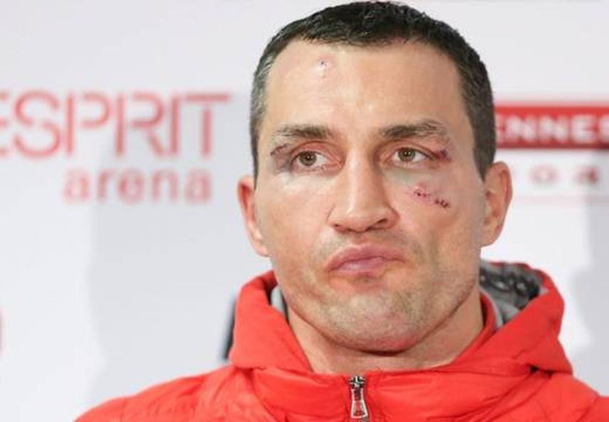 Klitschko asegura que no di su mejor versión ante Fury. (EFE)
