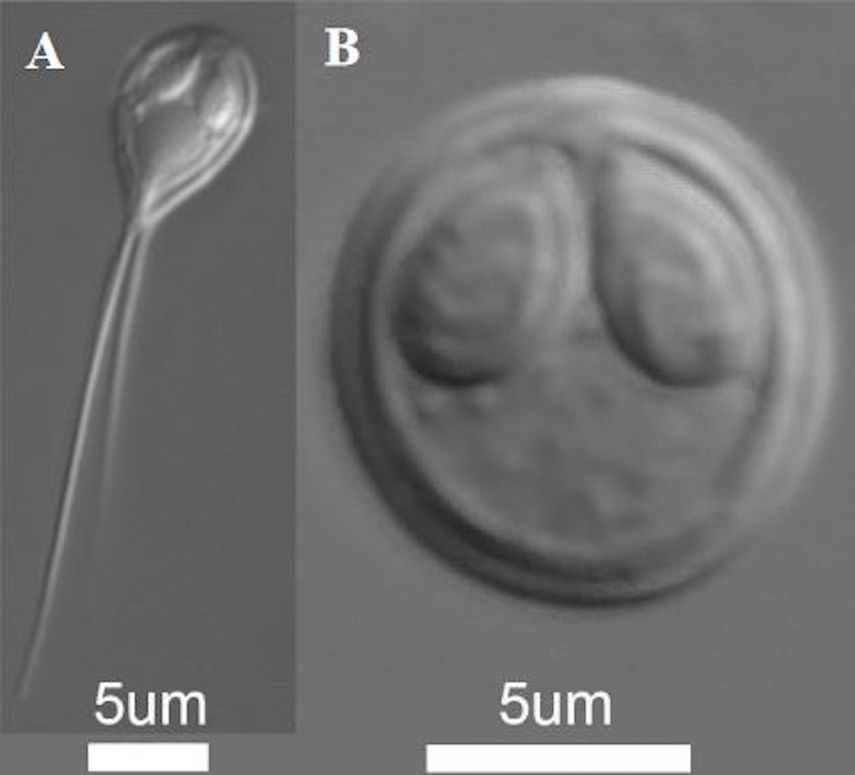 Mixosporas de los dos par&aacute;sitos mixozoarios estudiados. A. Henneguya salminicola, B. Myxobolus squamalis.