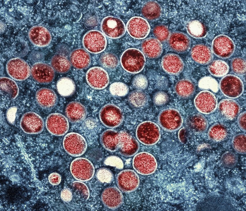 En esta imagen sin fecha, proporcionada por el Instituto Nacional de Enfermedades Alérgicas e Infecciosas (NIAID, por sus siglas en inglés) se muestra una micrografía electrónica coloreada de partículas de mpox, viruela símica (en rojo) halladas dentro de una célula infectada (azul), cultivada en laboratorio, captada y coloreada en el Centro de Investigación Integrada del NIAID en Fort Detrick, Maryland.&nbsp;