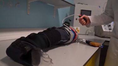 Terry Gourlay, jefe del departamento de Ingeniería Biomédica de la Universidad de Strathclyde, dijo que esta técnica ha sido creada a partir de&nbsp;observar el tratamiento de los militares desplazados a zonas como Irak y Afganistán.