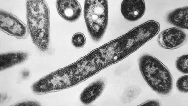 Esta imagen de 1978 tomada por microscopio electrónico y distribuida por los Centros de Control y Prevención de Enfermedades, muestra la bacteria Legionella pneumophila, causante de la legionelosis, una enfermedad pulmonar.&nbsp;