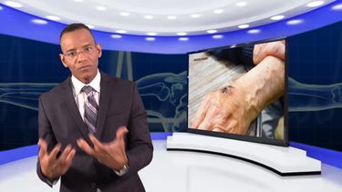 ¡cuidado con la bacteria comecarne!