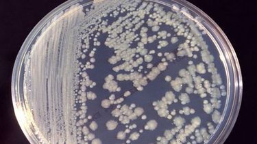 Cepas de Enterobacter, bacterias similares a organismos infecciosos oportunistas descubiertos en hospitales, se han identificado en la Estación Espacial Internacional.