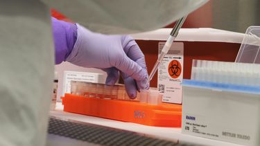 El microbiólogo del Departamento de Salud de Hawai Mark Nagata demuestra cómo funciona una prueba para detectar el coronavirus.