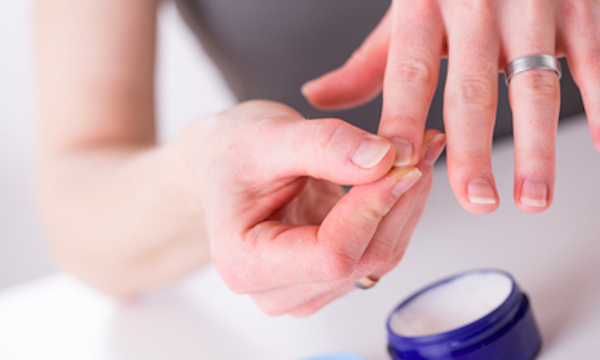 Las uñas necesitan de cuidados. Después de usar quitaesmaltes, hay que encremarlas bien.