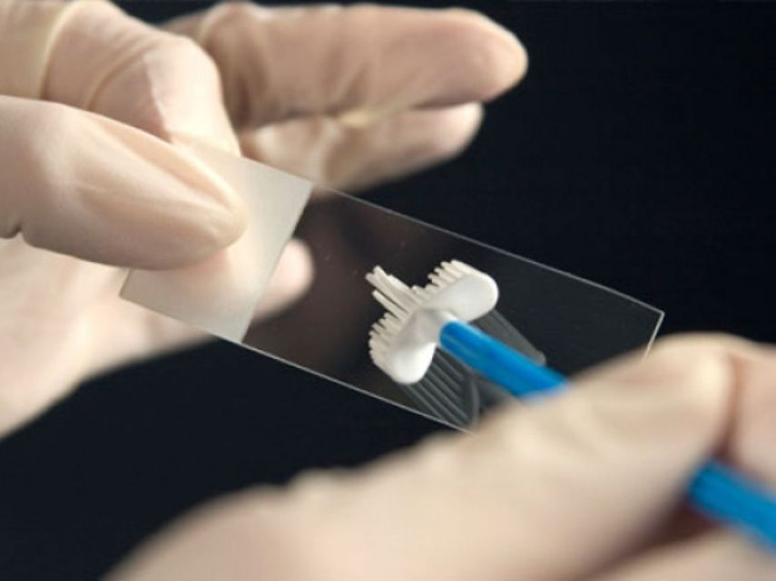 La prueba de Papanicolaou.&nbsp;