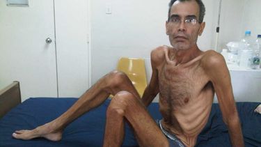 Franklin Brito llegó a pesar 35 kilos por la huelga que lo llevó a la muerte