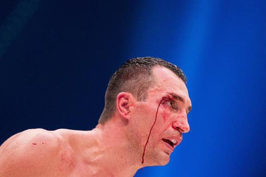 Klitschko cayó a los puntos por decisión unánime y reconoció la justicia del fallo. (EFE) 