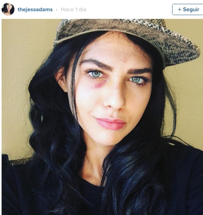 La actriz estadounidense Jess Adams fue golpeada en el rostro por un drone mientras participaba en una sesión de fotos en una playa de Malibú, California. Ese inesperado y violento episodio quedó registrado en un video. 