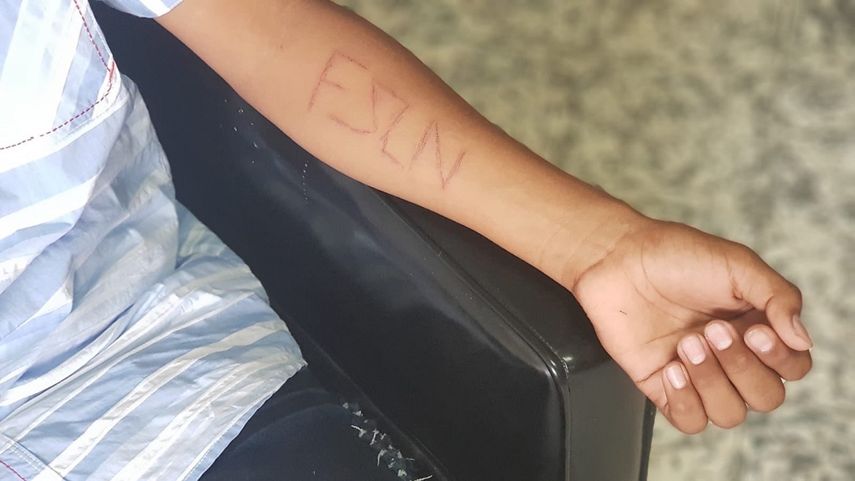 Denuncian que Policía en Nicaragua agredió a un niño de 14 años y le escribió con una jeringa las siglas FSLN.&nbsp;