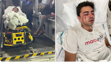 Un joven que hacía campaña en Hialeah fue golpeado brutalmente.