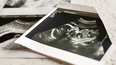 Nuevas leyes regulan el aborto en Estados Unidos.
