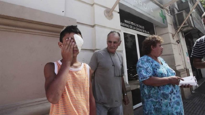 Las lesiones oculares están entre las más comunes entre los afectados por la pirotecnia en Buenos Aires.