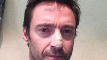 Hugh Jackman (Instagram)