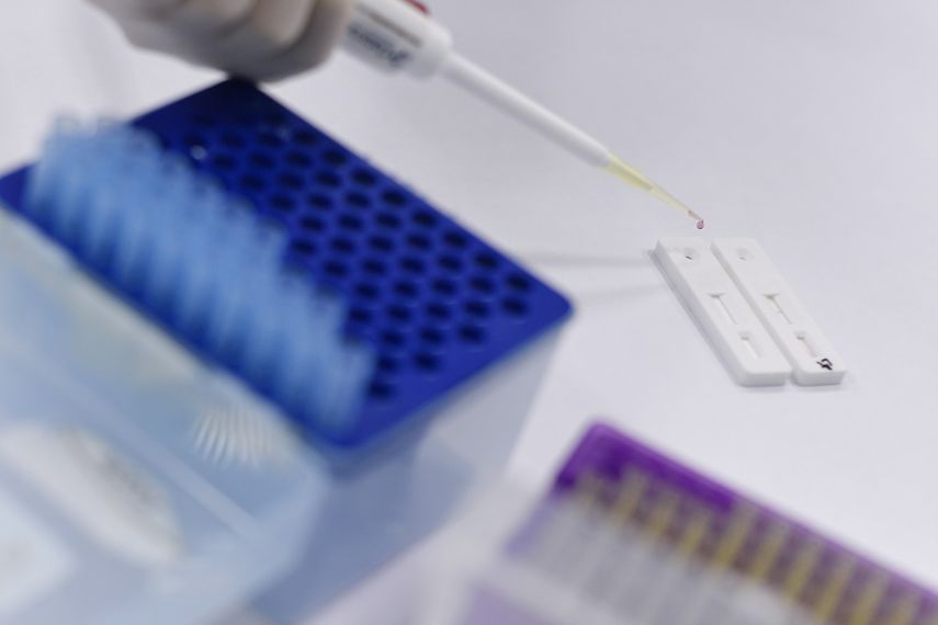 Investigadores en Belo Horizonte, Brasil, trabajan contrarreloj para lograr una vacuna contra el nuevo coronavirus COVID-19.