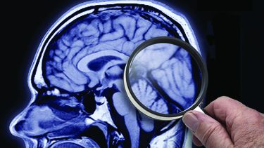 La pérdida permanente de la actividad cerebral implica que el afectado no puede respirar o mantener cualquier otra función vital por su cuenta&nbsp;