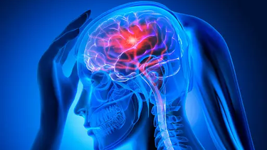 Persona sufriendo un Accidente Cerebrovascular (ACV)