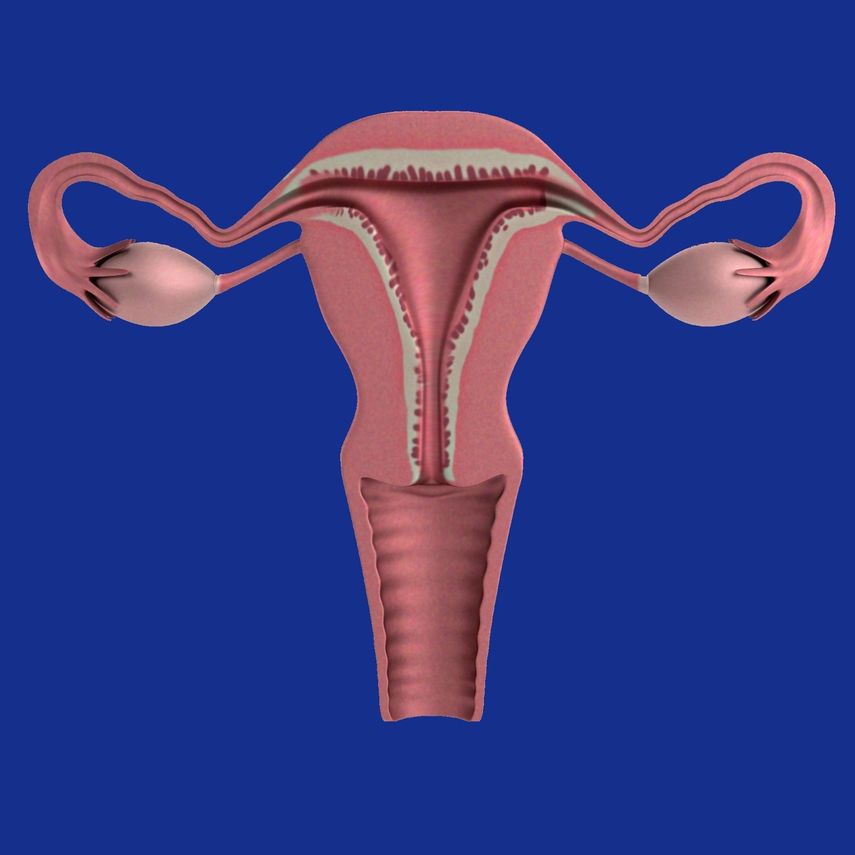 La OMS ha documentado que el síndrome de ovario poliquístico es una de las principales causas de menstruación irregular y una de las causas más comunes de infertilidad