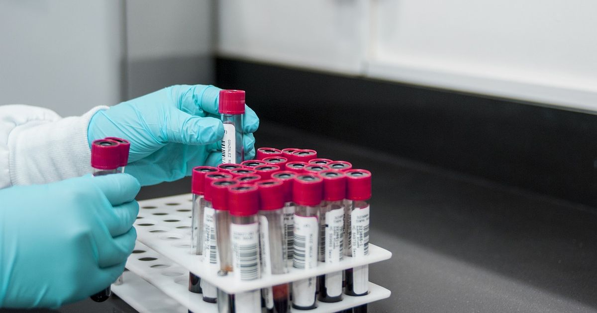 Exportar derivados de la sangre, el negocio lucrativo del régimen de Cuba