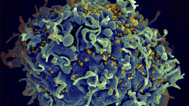 Esta imagen captada con un microscopio electrónico y facilitada por los Institutos Nacionales de Salud de Estados Unidos muestra una célula T, en azul, siendo atacada por el VIH, el virus que causa el sida, en amarillo.&nbsp;
