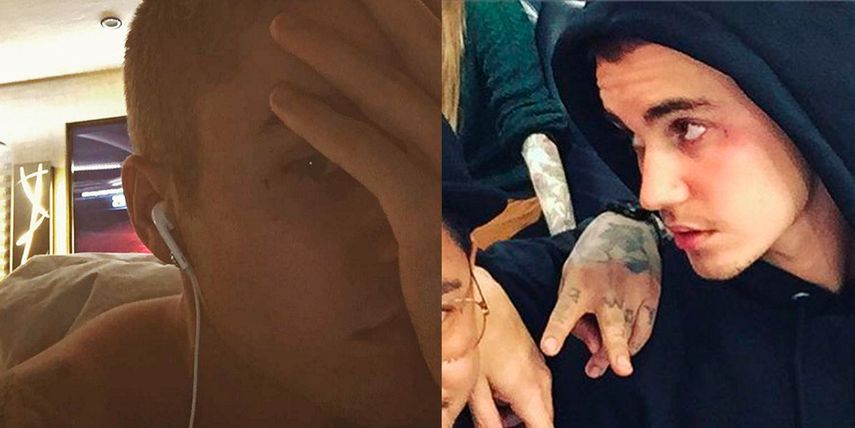 Tatuaje en la cara de Justin Bierber  (Instagram) 