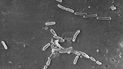 Esta imagen de microscopio electrónico proporcionada por los Centros para el Control y la Prevención de Enfermedades de EEUU muestra la bacteria Pseudomonas aeruginosa. 