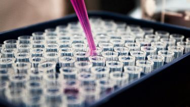 Imagen referencial.&nbsp;