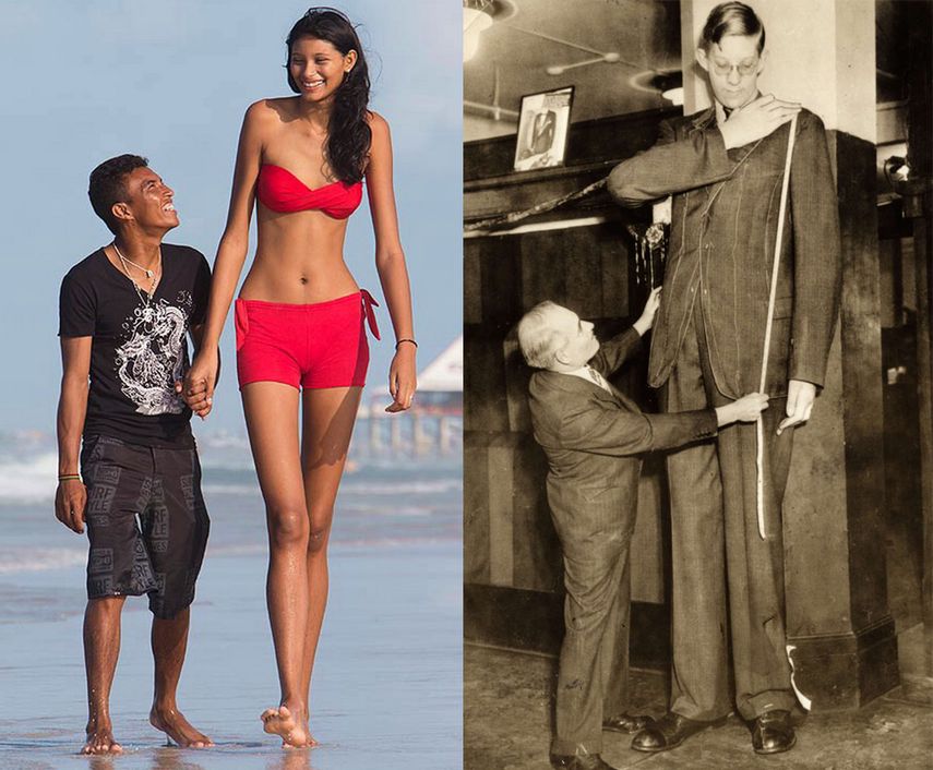 En más del 90% de los casos, la acromegalia es consecuencia  de un tumor benigno en la glándula pituitaria, encargada de excretar la hormona de crecimiento, denominada con las siglas GH, y se caracteriza por el crecimiento desproporcionado del cuerpo.