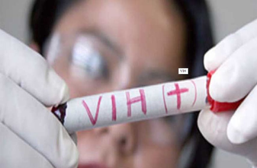 Los enfermos de VIH en el país caribeño tienen como promedio más de 30 años y el 80% son hombres.