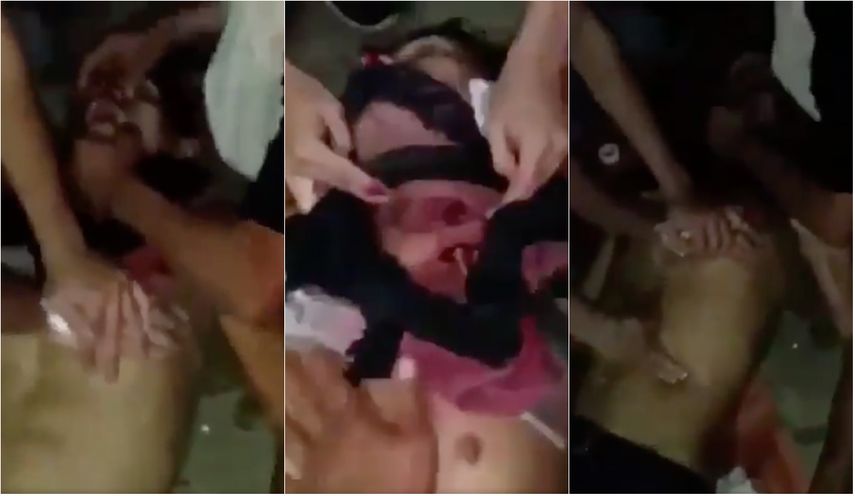 Un video captó el estado en el que quedó un estudiante tras ser atacado brutalmente por las fuerzas policiales.