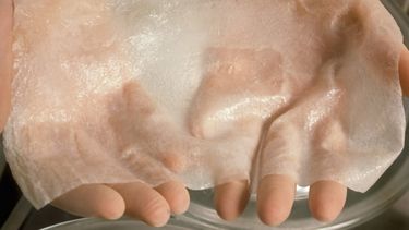 La piel de cerdo y la humana tienen un 78% de compatibilidad. (ESPECIAL)